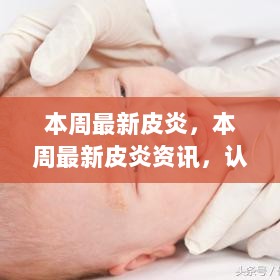 本周最新皮炎资讯，认识、预防与治疗新进展的探讨