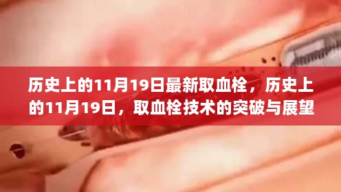 历史上的11月19日，取血栓技术的突破与展望