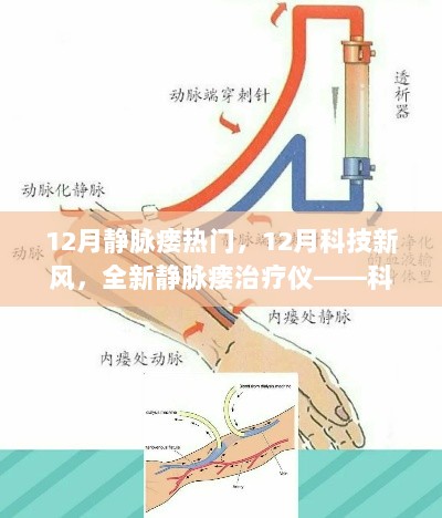 12月科技新风下的静脉瘘治疗革新，全新静脉瘘治疗仪引领健康新生活