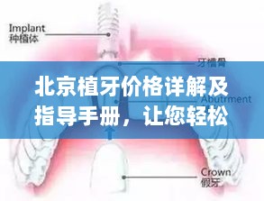 北京植牙价格详解及指导手册，让您轻松了解牙齿种植费用