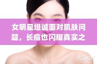 女明星坦诚面对肌肤问题，长痘也闪耀真实之美