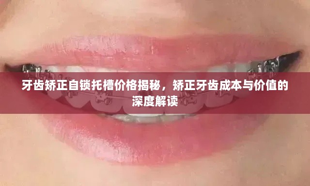 牙齿矫正自锁托槽价格揭秘，矫正牙齿成本与价值的深度解读